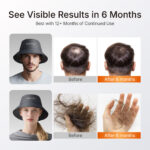 Red Light Therapy Hair Growth Cap Device - Image 11